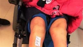 中國大陸,性侵,女屍,截肢,失明,凍傷,女學生（圖／翻攝自騰訊新聞）https://news.qq.com/a/20171207/005403.htm