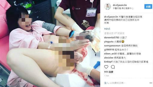 獨／PO婦親手接生用意？醫師這麼說