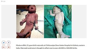 美人魚寶寶 圖/翻攝自cetusnews