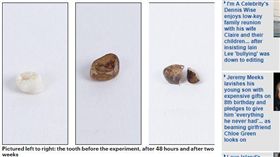 飲料對牙齒的影響