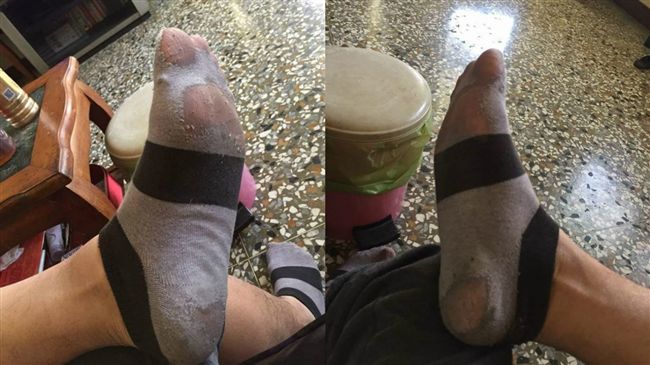 男友襪子穿到變絲襪　網友：哪買的？