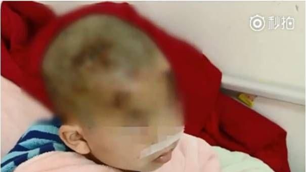 捨身保護妹妹…5歲男童遭藏獒狠咬