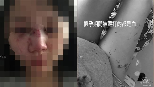 懷胎8個月疑遭家暴　夫妻牽手破謠言