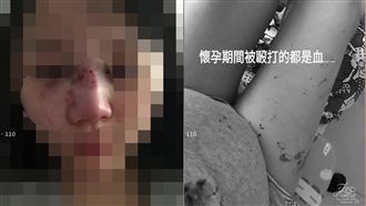 懷胎8個月疑遭家暴　夫妻牽手破謠言