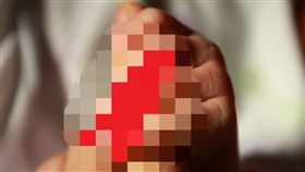 斷指、手指受傷（示意圖）／pixabay