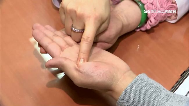 手掌看健康！大魚際沒彈性要注意心肺
