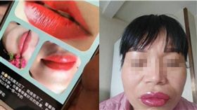  繡唇,大陸,陝西,美容院,紅腫,嘴唇,發炎　圖／翻攝自微博