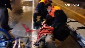 翁騎車自摔頭冒鮮血　警急迴轉救援