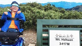 魏益群，罕病，纖維性骨失養症。（當事人提供）