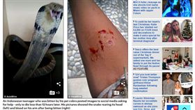 印尼,阿利爾,Ari,l眼鏡蛇,咬傷(dailymail http://www.dailymail.co.uk/news/article-5193715/Boy-dies-hours-picturing-cobra-bite-Indonesia.html)