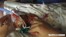混血兒巴掌仙子恩恩，出生時體重僅1144克，在先前醫護人員細心照護與家人後續的觀察照料下，已順利成長至一歲多。（圖／國泰　醫院提供）