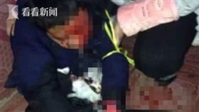 大陸江西少年聽MP3，發生爆炸，遭嚴重炸傷／看看新聞