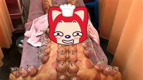不少人有到中醫診所拔罐的經驗，但有一名男網友分享他拔罐的照片，嚇壞不少網友，而這樣拔罐的情況，也讓不少網友直呼「密集恐懼症發作」，甚至還有其他網友好奇問，「蛋蛋那邊也有拔嗎？」（圖／翻攝自爆廢公社）