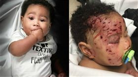 浣熊,Samuel Black,Journi Black,Ashley Rodgers,動物,襲擊,咬傷,攻擊　圖／翻攝自Philly　https://goo.gl/Xdtds3