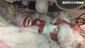 國泰醫院,新生兒,早產兒,早產,巴掌仙子,妊娠