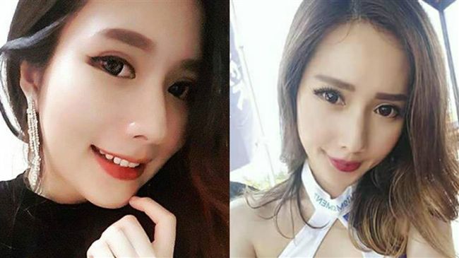 女模K歌飆高音頭劇痛　昏迷3天驟逝