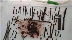 金屬,俄羅斯,Ulan-Ude,釘子,螺絲,門栓,鐵質,貧血　圖／翻攝自rt.com