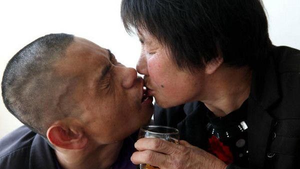 老母咬碎飯菜　口對嘴餵食病兒37年
