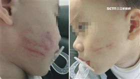 台中,2歲臉頰有巴掌印疑似遭保母虐待,保母摑童臉1800