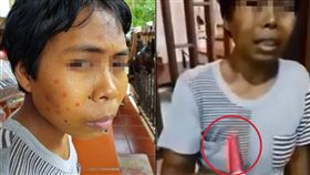 好會演! 外傭想休假 拿紅筆畫臉謊稱長紅斑