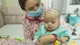 兒患罕病慢慢石化…醫師父卻束手無策（圖／翻攝自成都商報）