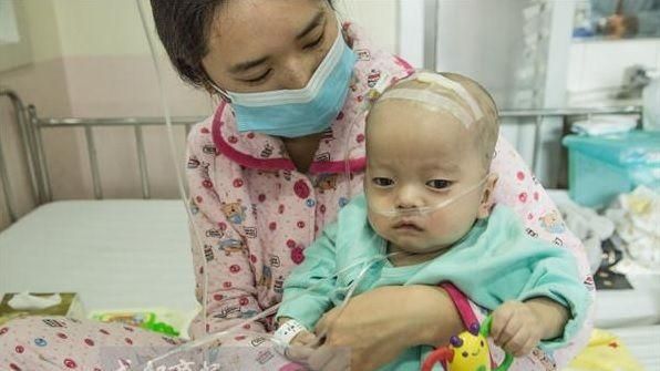 兒患罕病慢慢石化…醫師父卻束手無策
