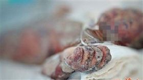 中國大陸,甲醇,爆炸,取暖,灼燒,火人,著火（圖／翻攝自微博）