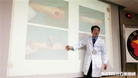 三總整形外科主治醫師暨燒傷中心主任曾元生說明褥瘡治療方式。（圖／記者楊晴雯攝）
