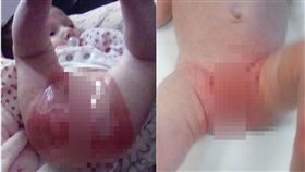 扯！女嬰穿這款尿布屁股爛掉
翻自《太陽報》