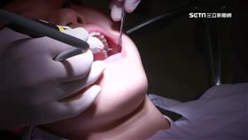 -牙醫-看牙-拔牙-植牙-