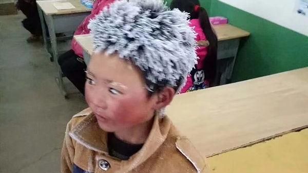 獲百萬捐款　冰霜男孩只收到2千元…
