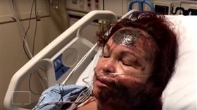 美國,紐約,婦人謊稱潑灑酸性物質隨機攻擊,毀容(圖/https://www.youtube.com/watch?v=NcfZAhrJaW0)