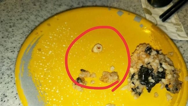 餐廳吃到假牙　網友：比吃到小強驚悚
