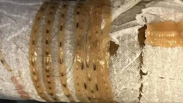 嗜吃生魚片　男上廁所驚見1.6米蟲