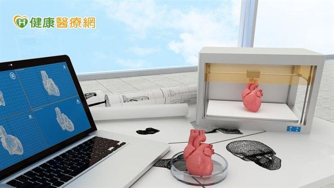 3D列印技術　降低心瓣膜手術風險
