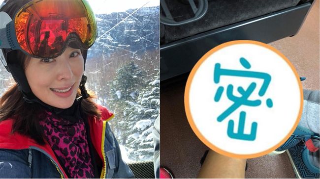 女星扭傷堅持滑雪　腳踝骨折腫如豬蹄