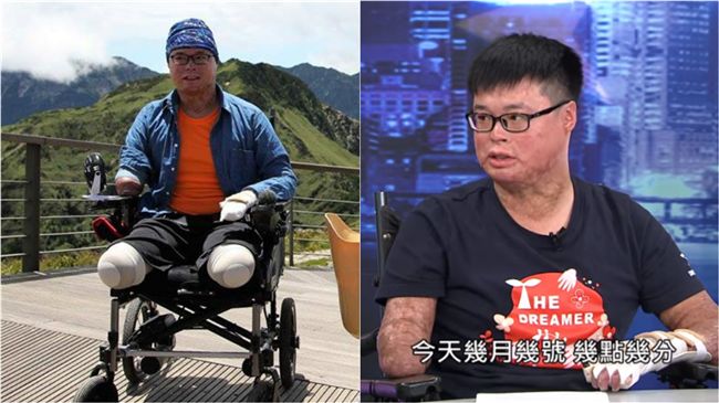 塵爆傷者存活率5％…爸媽探病先報時