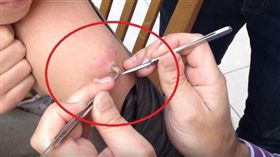 膚蠅幼蟲（圖／翻攝自Guy Sterne YouTube）