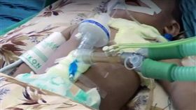 烏茲別克,男嬰,針,虐童（圖／翻攝360tv.ru）