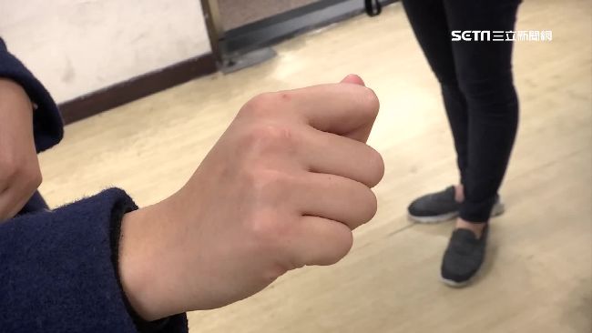 瘋狂粉絲送糖果　竟害小模遭「針」刺