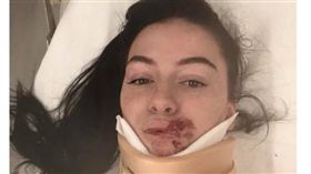 少女開車遇劫匪　慘遭拖行毀容險死（圖／翻攝自Taylor Hall臉書）https://www.facebook.com/photo.php?fbid=1527699847350342&set=pcb.1527699897350337&type=3&theater