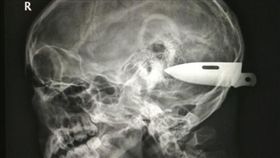 大陸,重慶,小李飛刀,情敵,插腦 (圖/翻攝新浪網)