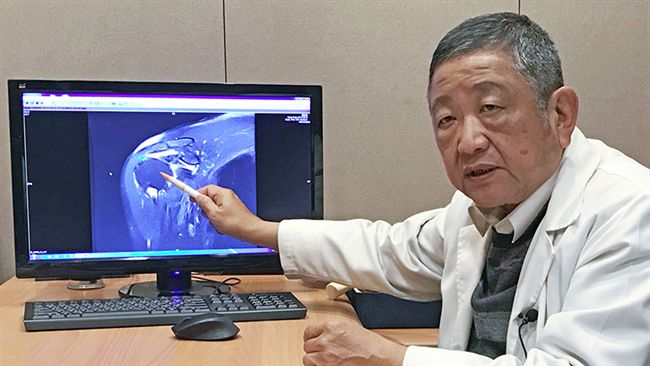 運動傷害手不舉　竟是肩膀肌腱破裂！