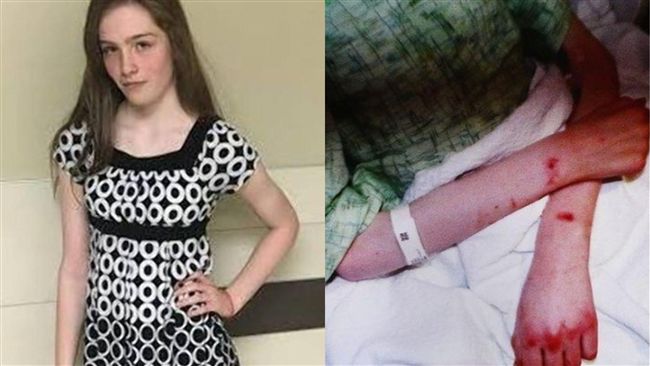 斷食還逼喝馬桶水！狠母餓死14歲女