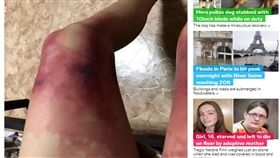 哈薩克,凍傷,女大生,短裙,褲襪,Astana　圖／翻攝自METRO