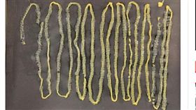 長期愛吃生魚片！竟拉出2.8公尺絛蟲　患者嚇傻
圖／翻攝自鏡報