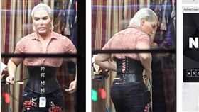 巴西艾維斯（Rodrigo Alves）切除4根肋骨。（圖／翻攝自Daily Mail Online）