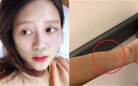 嚴立婷安胎針打到手腫又變形,翻攝自臉書、IG