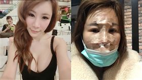 艾美琦,整容,地震/翻攝自艾美琦微博,IG