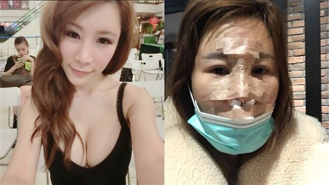 來台整型遇強震！港星崩潰：差點毀容